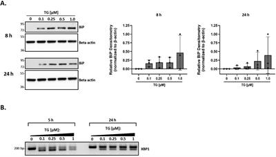 A comprehensive analysis of the role of native and modified HDL in ER stress in primary macrophages